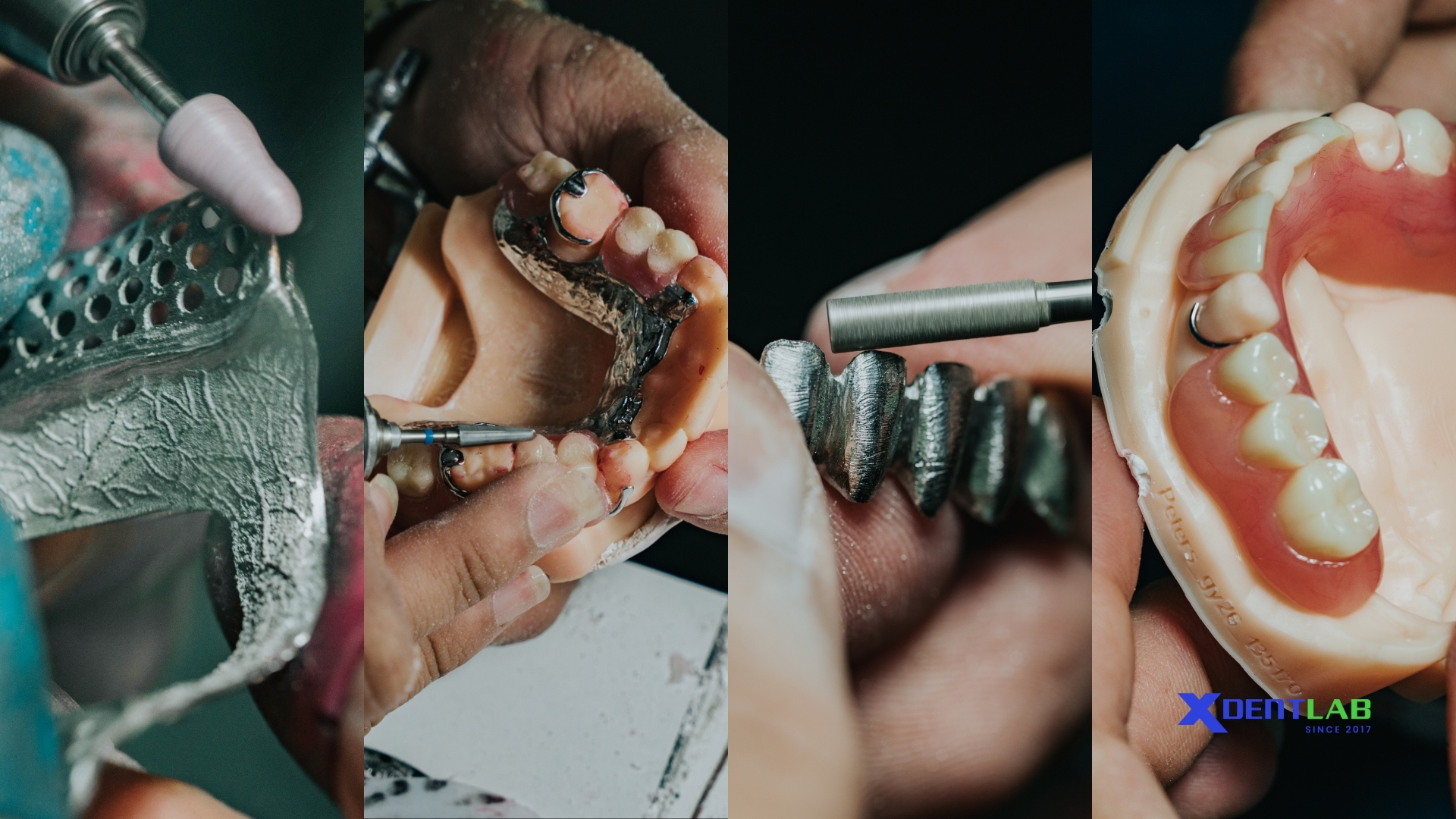 conclusion-dental-labs