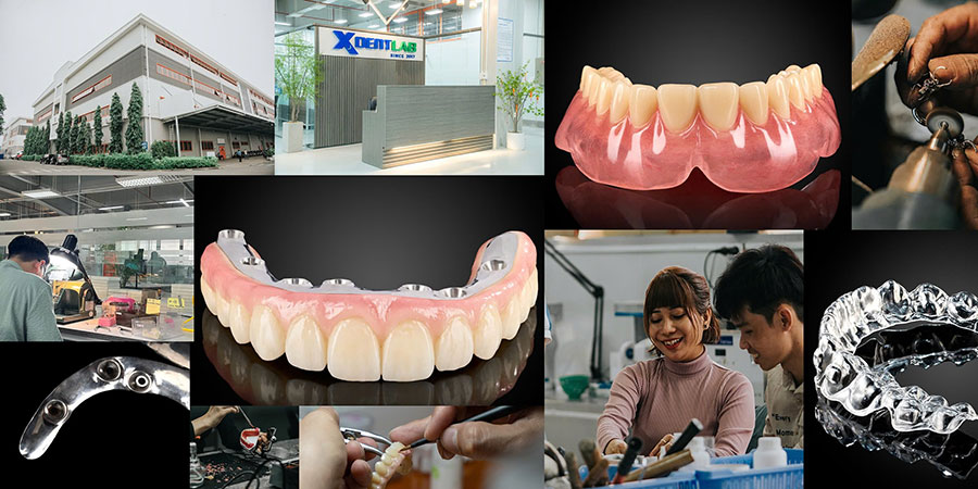 XDENT LAB – A Trusted Lab-to-Lab Service from Vietnam XDENT LAB – A Trusted Lab-to-Lab Service from Vietnam