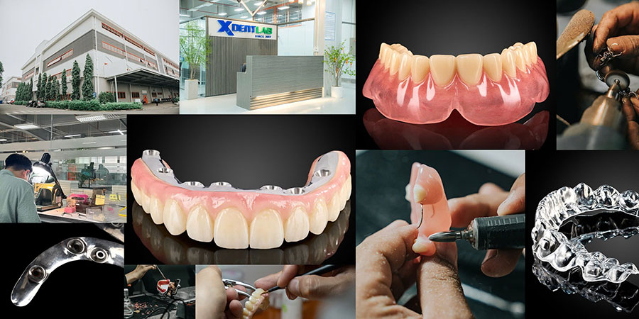 XDENT LAB is an expert in Lab-to-Lab Full Service from Vietnam XDENT LAB is an expert in Lab-to-Lab Full Service from Vietnam