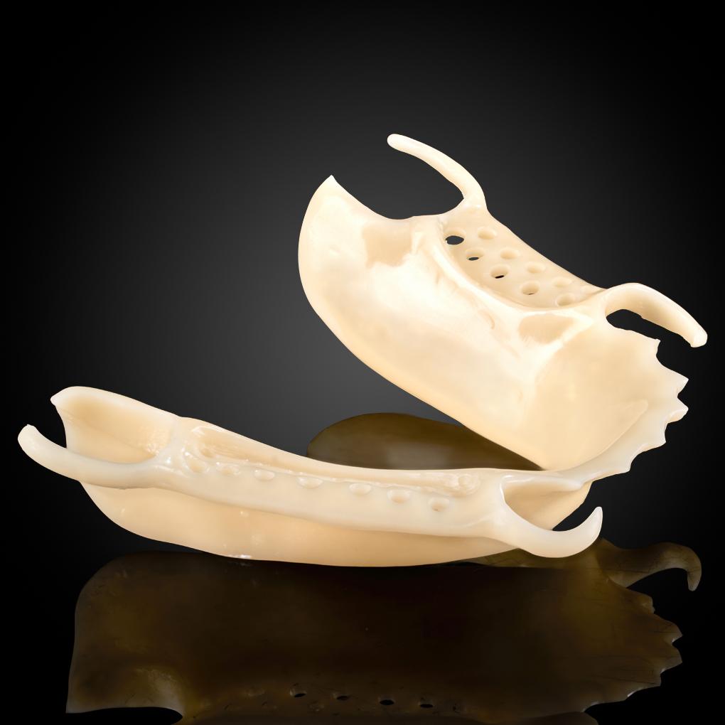 Acetal Frame Partial Denture Acetal Frame Partial Denture