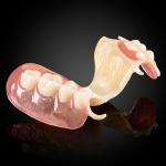 Acetal Framework Partial Denture
