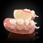 Acetal Framework Partial Denture