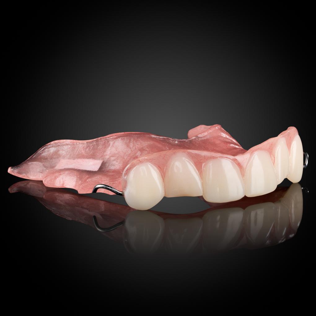 Acrylic Partial Denture Acrylic Partial Denture