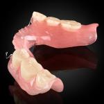 Acrylic Partial Denture