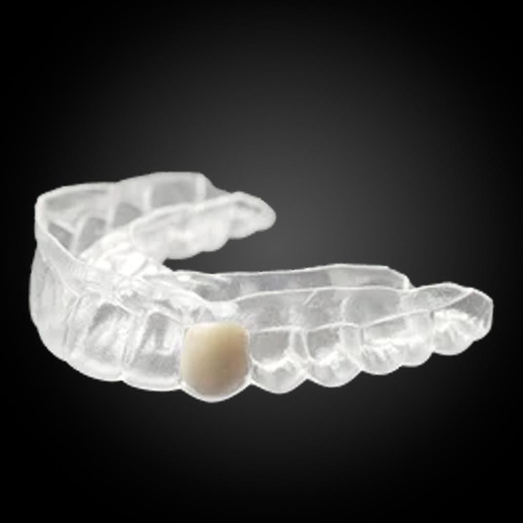 Clear Essix Partial Denture Retainer Clear Essix Partial Denture Retainer
