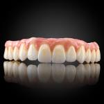 Esthetic Full Arch Implant