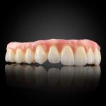 Esthetic Full Arch Implant