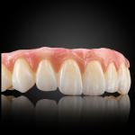 Esthetic Full Arch Implant