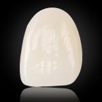 Esthetic Multilayer Zirconia