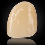 Esthetic Multilayer Zirconia