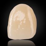 Esthetic Multilayer Zirconia