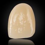 Esthetic Multilayer Zirconia