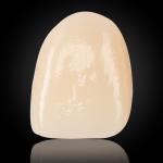 Esthetic Multilayer Zirconia