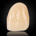 Esthetic Multilayer Zirconia