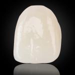 Esthetic Multilayer Zirconia