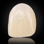 Esthetic Multilayer Zirconia