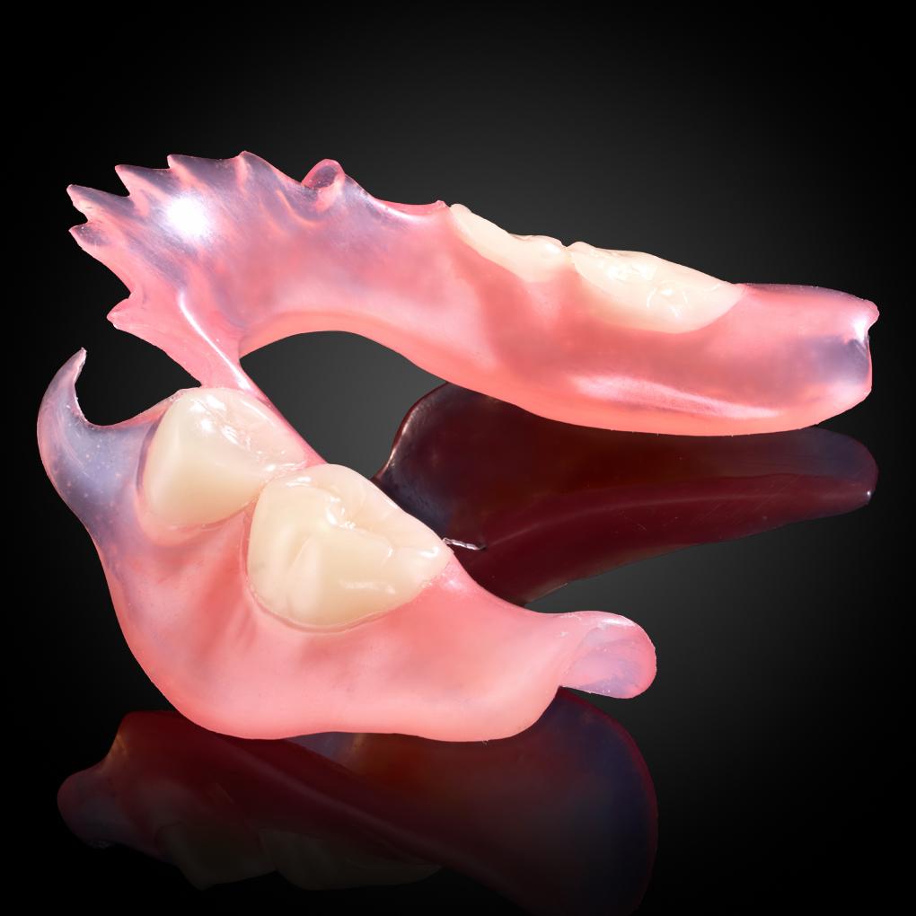 Flexible Partial Denture Flexible Partial Denture