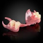 Phục Hình Tháo Lắp Bán Phần Nhựa Dẻo Phục Hình Tháo Lắp Bán Phần Nhựa Dẻo