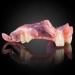 Phục Hình Tháo Lắp Bán Phần Nhựa Dẻo Phục Hình Tháo Lắp Bán Phần Nhựa Dẻo