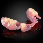 Phục Hình Tháo Lắp Bán Phần Nhựa Dẻo Phục Hình Tháo Lắp Bán Phần Nhựa Dẻo