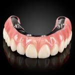 Full Arch Hybrid Bar