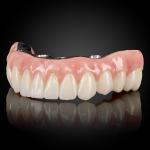 Full Arch Hybrid Bar