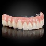 Full Arch Hybrid Bar