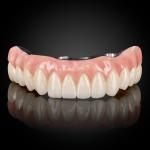 Full Arch Hybrid Bar
