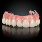 Full Arch Hybrid Bar