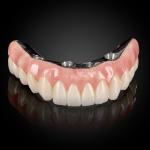 Full Arch Hybrid Bar