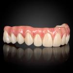 Full Arch Implant