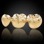 Full Cast Gold Crown