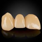 Layered Zirconia