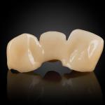 Layered Zirconia