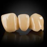Layered Zirconia