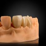 Layered Zirconia