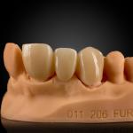 Layered Zirconia