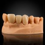 Layered Zirconia