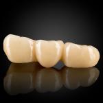 Monolithic Zirconia