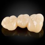 Monolithic Zirconia
