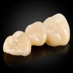 Monolithic Zirconia
