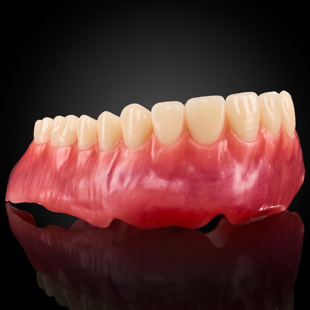 Wax Try-In Wax Try-In