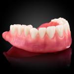 Wax Try-In