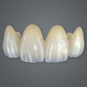 crown-and-bridge-esthetic-multilayer-zirconia