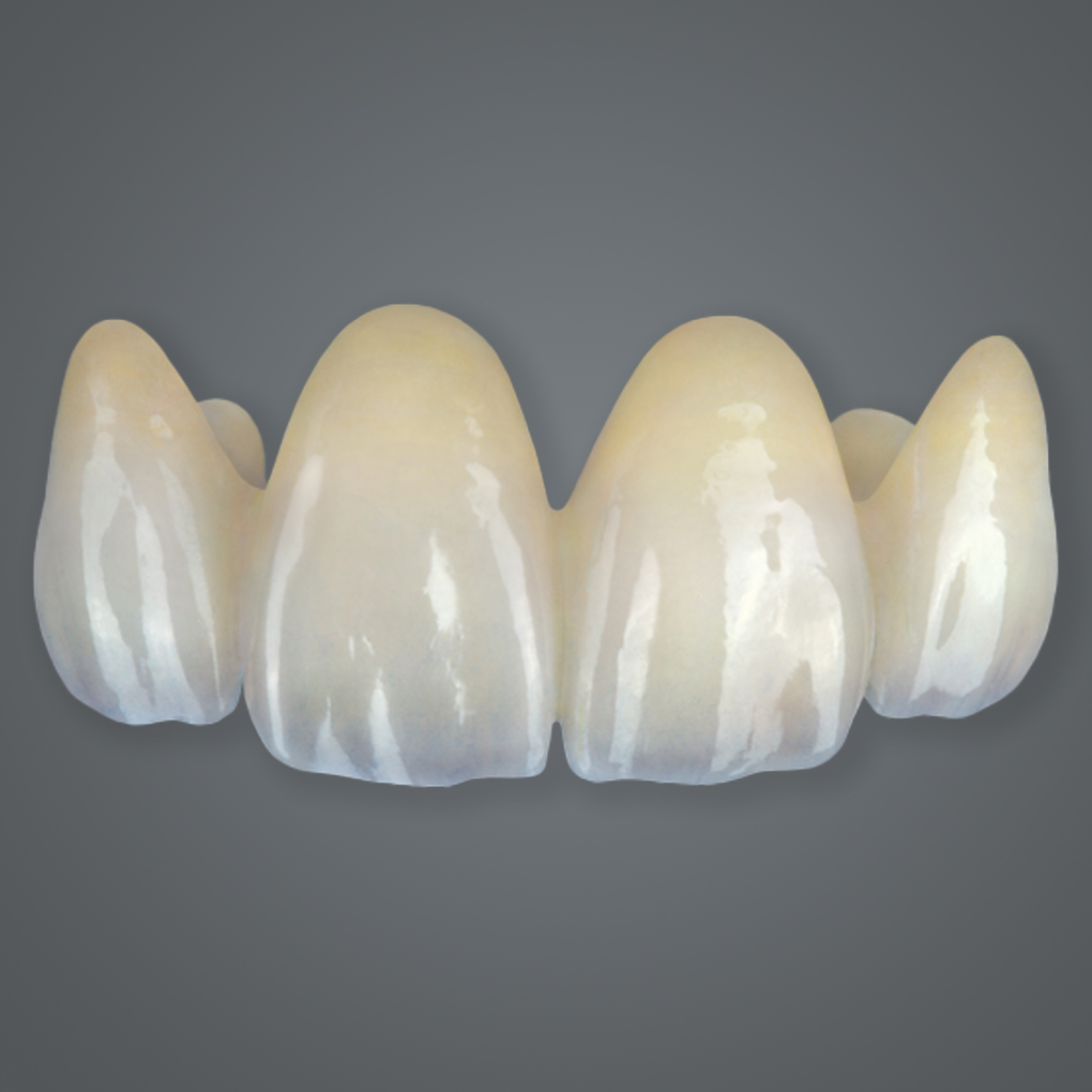 esthetic-multilayer-zirconia