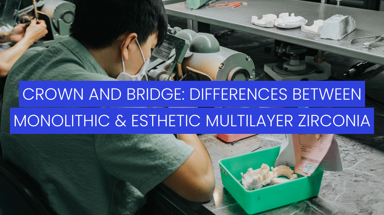 crown-and-bridge-differences-between-monolithic-zirconia-and-esthetic-multilayer-zirconia