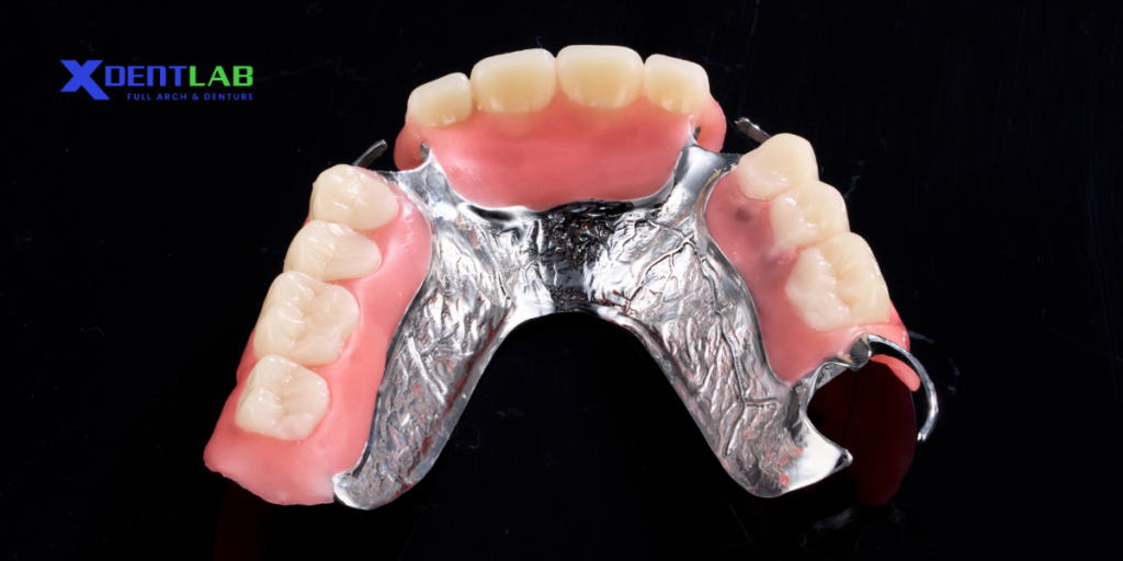 metal-frame-partial-dentures-types-of-removable-dentures